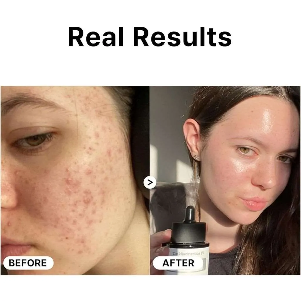 COSRX The Niacinamide 15 Serum 20ml